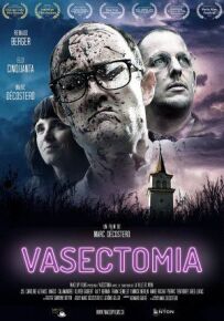 Вазектомія