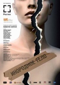 Стороннє тіло
